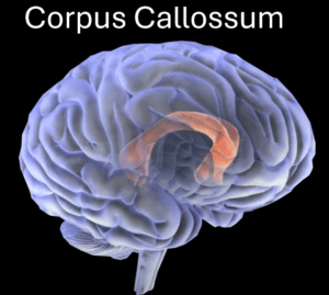 Das Bild zeigt den Corpus Callossum - den Zwischenbalken im Gehirn